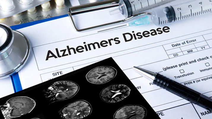 New Alzheimer’s Drug got its approval from FDA almost after 20 years